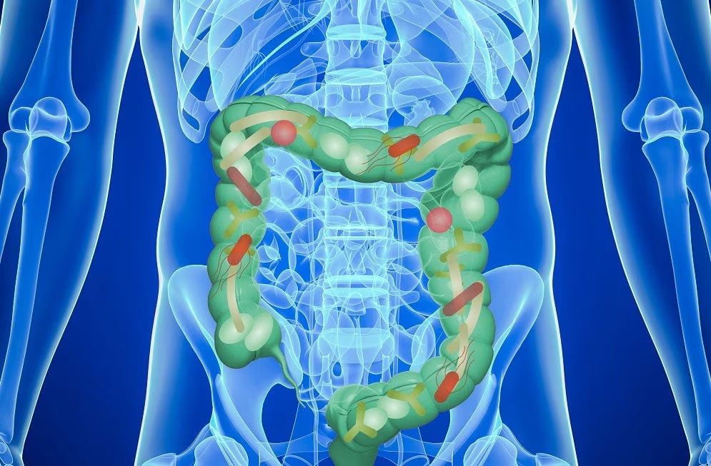 Erfahren Sie mehr über alle Einsatzmöglichkeiten mit OptiFibre®