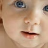 Symptome: Ekzem und Reflux
