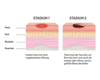 Resource - Alle SKINPLUS Produktempfehlungen