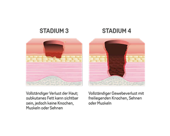 Resource - Alle SKINPLUS Produktempfehlungen