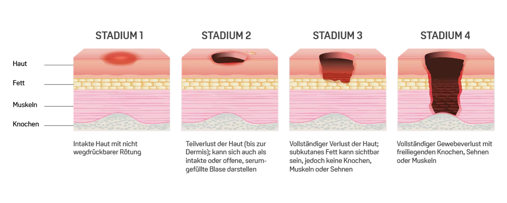 Resource - Alle SKINPLUS Produktempfehlungen
