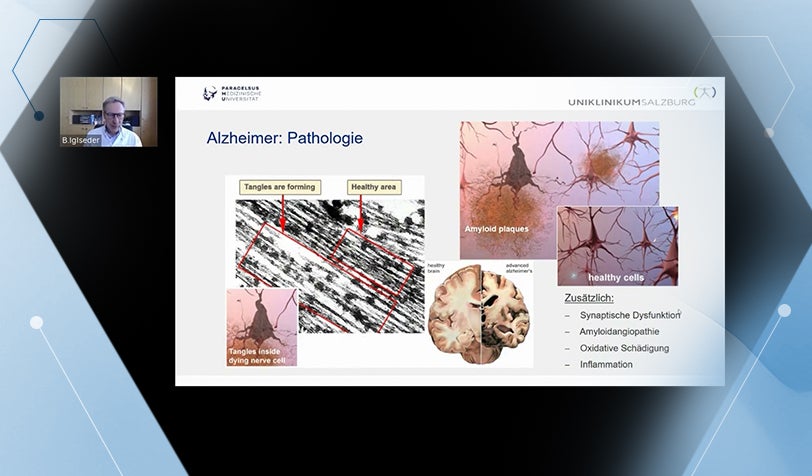 Webinar Demenz & Ernährung – Wissenschaftliche Grundlagen und praxisnahe Lösungen