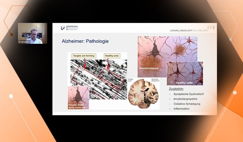 Webinar Demenz & Ernährung – Wissenschaftliche Grundlagen und praxisnahe Lösungen