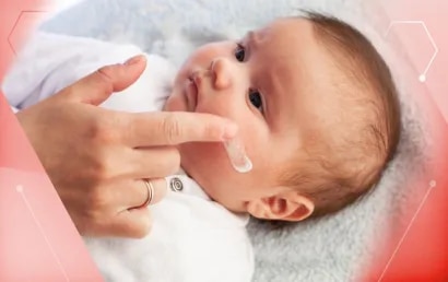 Ein Baby mit Hautausschlag im Gesicht aufgrund einer Kuhmilchallergie wird eingecremt.
